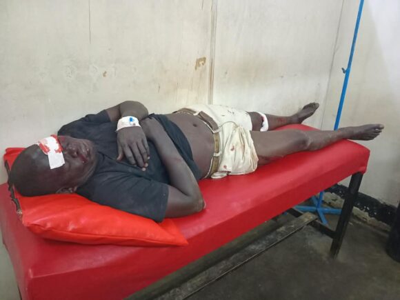EMERGENCY SUPPORT FOR OUR REFEREE MOSES AFTER ACCIDENT